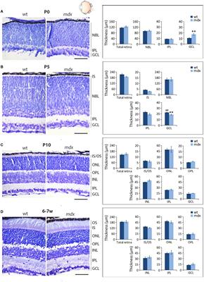 Dystrophin Is Required for the Proper Timing in Retinal Histogenesis: A Thorough Investigation on the mdx Mouse Model of Duchenne Muscular Dystrophy